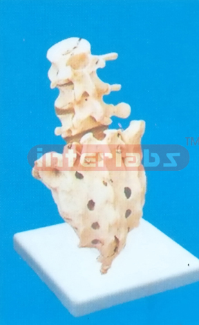 SPONDY LOLISTHESIS MODEL